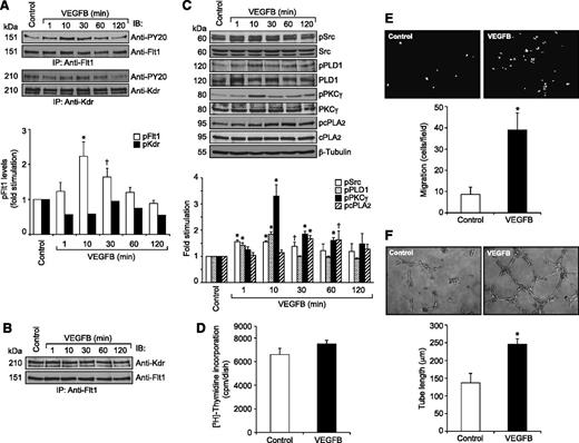 Figure 6. VEGFB stimulates Flt1 tyrosine phosphorylation and Src-PLD1-PKCγ-cPLA2 activation in HRMVECs as well as the migration and tube formation of these cells. (A) Quiescent HRMVECs were treated with and without VEGFB (40 ng/mL) for the indicated time periods and cell extracts were prepared. An equal amount of protein from control and each treatment group was immunoprecipitated with anti-Flt1 or anti-Kdr antibodies and the immunocomplexes were analyzed by western blotting using anti-PY20 antibodies. The blots were reprobed with anti-Flt1 or anti-Kdr antibodies for normalization. (B) All the conditions were the same as in panel A except that the cell extracts consisting of an equal amount of protein from control and each treatment were immunoprecipitated with anti-Flt1 antibodies and the immunocomplexes were immunoblotted with anti-Kdr antibodies. (C) All conditions were the same as in panel A except that an equal amount of protein from control and each treatment group was analyzed for pSrc, pPLD1, pPKCγ, and pcPLA2 levels using their phosphospecific antibodies. The blots were reprobed with anti-Src, anti-PLD1, anti-PKCγ, anti-cPLA2, or anti-β-tubulin antibodies for normalization. (D-F) Quiescent HRMVECs were treated with and without VEGFB (40 ng/mL) and subjected to DNA synthesis (D), migration (E), or tube formation (F) as described in the Figure 3 legend. The representative HRMVEC migration and tube formation images are shown in panels E and F, respectively. The bar graphs in panels A and C-F represent the quantitative analysis of 3 independent experiments. The values are presented as mean ± SD. *P < .01 vs control; †P < 0.05 vs control.