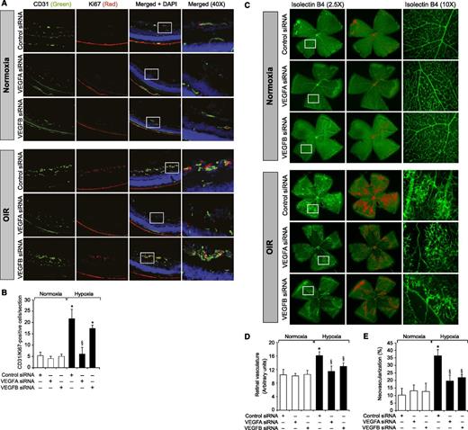 Figure 8. Downregulation of VEGFA and VEGFB blocks hypoxia-induced retinal EC proliferation and neovascularization. (A-E) All the conditions were the same as in Figure 5 except that the mice pups were administered with control, VEGFA, or VEGFB siRNA. Retinal EC proliferation and neovascularization were measured as described in “Materials and methods.” (A) Retinal EC proliferation was detected by coimmunofluorescence staining of the retinal sections for CD31 and Ki67. The right column shows the higher magnification (×40) of the selected areas (rectangular boxes) from the images shown in the left column. (B) Retinal EC proliferation was measured by counting CD31- and Ki67-positive cells that extended anterior to the inner limiting membrane per section (n = 6 eyes, 3 sections/eye). (C) Retinal vascularization is shown in the first row. Neovascularization is highlighted with red color in the second row. The third row shows selected rectangular areas of the images shown in the first row under ×10 original magnification. (D) The bar graph shows quantification of retinal vascularization. (E) The bar graph shows quantification of retinal neovascularization. The values are presented as mean ± SD (n = 6 retinas). *P < .01 vs normoxia + control siRNA; §P < .01 vs hypoxia + control siRNA.