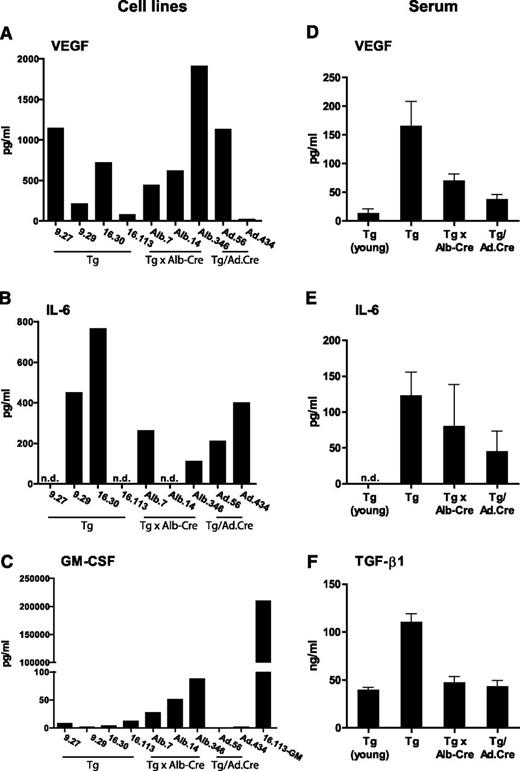 Figure 5. Cytokine levels released by cell lines established from autochthonous tumors and in the serum of tumor-bearing mice. (A-C) VEGF and IL-6 are secreted by oncogene-driven autochthonous tumors. VEGF, IL-6, and GM-CSF levels were determined in cell culture supernatants of cell lines established from Tg mice bearing sporadic tumors (9.27, 9.29, 16.30, 16.113), HCC-bearing Tg x Alb-Cre mice (Alb.7, Alb.14, Alb.347), and Tg/Ad.Cre mice bearing virus-induced HCC (Ad.56, Ad.434). Retrovirally transduced 16.113 cells (16.113-GM) were tested for GM-CSF levels only. (D, E) VEGF and IL-6 were determined in sera of young Tg mice (n = 5 and n = 4), Tg mice (n = 8 and n = 38), Tg x Alb-Cre mice (n = 10 and n = 4), and Tg/Ad.Cre mice (n = 4 and n = 13). Note that no GM-CSF could be detected in sera of the mice shown above (data not shown). (F) TGF-β1 levels were determined in sera of young Tg mice (n = 4), Tg mice (n = 7), Tg × Alb-Cre mice (n = 4), and Tg/Ad.Cre mice (n = 4). Bars indicate means; error bars represent SEM; n.d. = not detected.