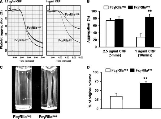 Figure 2. Ectopic expression of FcγRIIa potentiates platelet activation. (A) Representative aggregation tracings for WT FcγRIIaneg vs FcγRIIapos platelets in response to low- and medium-dose CRP. (B) Quantitation of platelet aggregation (mean percent aggregation ± SEM, n = 4 per group). (C) Representative photograph of thrombin-induced clot retraction. Washed platelets from WT or FcγRIIa transgenic mice were resuspended in plasma at a final concentration of 3 × 108/mL. Thrombin (0.2 U/mL) and CaCl2 (1mM) were added to initiate clot retraction. Images were taken 30 minutes later. (D) Quantification of plasma volume remaining following removal of the fibrin clot 30 minutes after initiation of the reaction. Results represent the mean ± SEM (n = 4 per group, **P < .01). Note that the presence of the FcγRIIa transgene enhances fibrin clot retraction at this early time point.