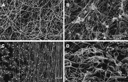 Figure 3. Scanning electron microscope images of clots and thrombi. In vitro clots made from human (A) platelet-poor plasma and (B) platelet-rich plasma. (C) The fibrin formed on a surface coated with collagen-adherent platelets is made up of many fibers aligned along the direction of flow. (D) The image shows an ex vivo human coronary artery thrombus obtained by aspiration from a patient with ST-elevation myocardial infarction. Magnification bars represent 10 μm.