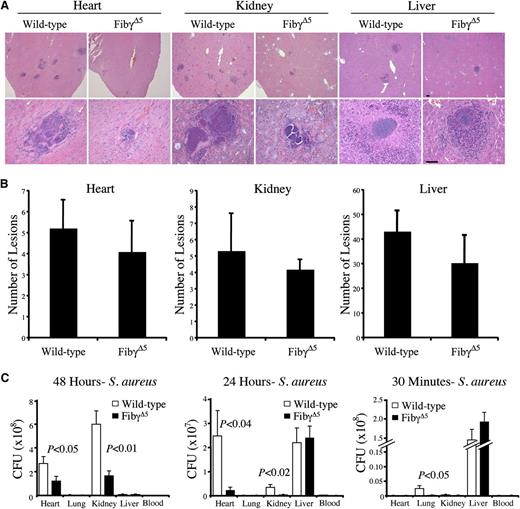 Figure 5. Comparative analyses of abscess formation and bacterial burden in tissue from FibγΔ5 and wild-type mice following intravenous S. aureus infection. (A) Representative hematoxylin/eosin-stained sections of heart, kidney, and liver from wild-type and FibγΔ5 mice collected 48 hours after intravenous infection with 2.5 × 108 CFUs wild-type S. aureus. Images were captured using an Axioplan 2 microscope with Axiovision Image analysis software (version 4.8.1; Carl Zeiss Microimaging). Scale bar represents 100 μm (upper panels) and 50 μm (lower panels). (B) Bacterial lesion counts in tissue sections prepared from heart, kidney, and liver of wild-type and FibγΔ5 mice 48 hours after intravenous infection. Data are presented as the mean number of lesions per tissue midline section ± standard error of the mean (SEM) with N = 5 per group. (C) Bacterial burdens observed in major organs of FibγΔ5 and control mice at 48 hours (left panel), 24 hours (middle panel), and 30 minutes (right panel) following intravenous injection of 2.5 × 108 CFUs S. aureus (N = 5 per group per time point). Values in solid tissues are the total mean CFUs ± SEM within the entire organ as determined by serial plating aliquots of tissue homogenates. Values in blood are the mean CFUs ± SEM per milliliter in whole blood as determined by plating serial dilutions of whole blood collected from the inferior vena cava. The data were analyzed using the Student t test.