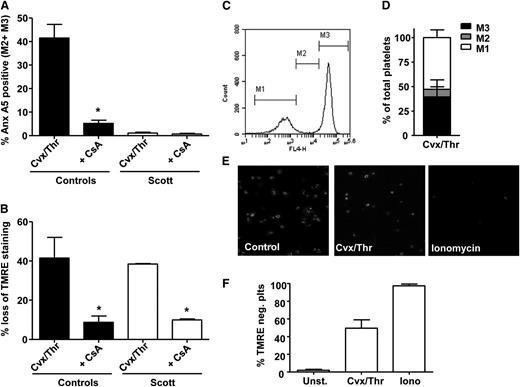 Figure 4. Cvx-/Thr-induced PS exposure is absent in Scott syndrome platelets despite normal cyclophilin D-dependent mitochondrial depolarization. (A-D) Platelets from healthy controls or a Scott patient were loaded with TMRE and preincubated with vehicle (dimethylsulfoxide) or cyclosporin A (CsA) (4 μM) for 10 min prior to stimulation by Cvx/Thr (70 ng/mL, 4 nM, for 15 min) in the presence of 2 mM CaCl2. Graphs show annexin (Anx) A5 binding (A) and loss of TMRE (B) of washed control and Scott syndrome platelets. (C-D) Representative histogram and bar graph showing the distribution of Cvx-/Thr-stimulated control platelets (15 min) over the fractions M1, M2, and M3. (E-F) TMRE-loaded Scott platelets adhered to fibrinogen (10 min) were stimulated with Cvx/Thr (70 ng/mL, 4 nM) or ionomycin (10 μM) in the presence of 2 mM CaCl2. (E) Representative images after 15-min stimulation, (F) The percentage of TMRE-negative platelets. Mean ± SEM (n = 3-6); *P < .05.