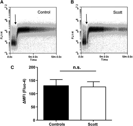 Figure 5. Scott syndrome platelets display normal convulxin (Cvx)-/thrombin (Thr)-induced Ca2+ responses. (A-B) Time drive of fluorescence increase of washed control (A) and Scott syndrome (B) platelets loaded with Fluo-4 and activated by Cvx/Thr (70 ng/mL, 4 nM) in the presence of 2 mM CaCl2. (C) Average change in mean fluorescence intensity (MFI), representing cytosolic Ca2+, after 10 min stimulation. n.s., not significant.