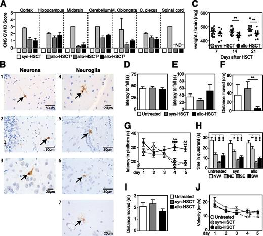 Figure 2. Cerebral alloreactive T-cell infiltration leads to cell damage and cognitive deficits. (A) Histopathological CNS findings in syngeneic and allogeneic transplanted animals. Lethal GVHD (0.5 × 106 T cells) assessed at day 21 (Allo1) or nonlethal GVHD (0.25 × 106 T cells) assessed at days 42 (Allo2) and 63 (Allo3). Control groups received equal number of syngeneic T cells. GVHD score (0 within normal limits, ≥ 1 pathology) and estimated infiltration with lymphocytes (0 none/rare, 1 mild, 2 moderate, 3 marked, 4 severe) using immunohistochemistry for CD3. (B) Terminal deoxynucleotidyltransferase-mediated deoxyuridine triphosphate nick end labeling staining in representative coronal brain sections 21 days after allo-HSCT in cerebellum gray matter (1, 2, 4), cortex (3), corpus callosum (5), hypothalamus (6), and hippocampus (7). (C) Wet brain weights after allo- and syn-HSCT (n = 13-14). (D) Accelerated Rotorod test measuring motor coordination by latency to fall. (E) Grip test measuring strength and neuromuscular function where latency to fall was measured. (F) Exploratory activity and anxiety was measured in an open field test where distance moved in center squares was measured. (G-H) Spatial memory and learning were assessed in the gold standard Morris water maze. (G) Time spent finding the platform over 5 consecutive days or (H) time spent in each quadrant were measured. (I) Motor function and mobility were assessed by measuring the total distance moved in the open field test. (J) Mobility was measured by examining the velocity in the Morris water maze. *Represents a comparison between syn-HSCT and allo=HSCT; ^Represents a comparison between untreated and allo-HSCT. For all behavioral tests, n = 20/treatment group. Bar graphs represent mean ± standard error of the mean of at least 2 independent experiments. *P < .05; **P < .01, ***P < .001.