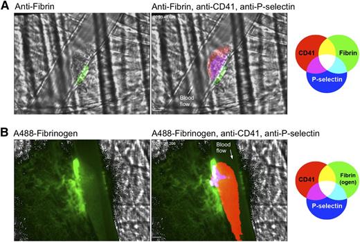 Figure 2. Fibrin localization partially overlaps with α-granule release in time and space. (A) Photomicrographs showing representative 2-dimensional confocal images illustrating localization of P-selectin and fibrin in a hemostatic plug following laser-induced injury. The image on the left shows the anti-fibrin (green) alone on the brightfield background. The image on the right shows platelets (CD41, red), P-selectin (blue), and fibrin (green) on the brightfield background; see color key at right for overlapping fluorophore colors. All 3 fluorescent channels are shown as binary images. Fibrin was imaged using an anti-fibrin antibody. (B) Representative photomicrographs illustrating localization of fibrin in the extravascular region adjacent to the site of laser injury. The image on the left shows Alexa-488–labeled fibrinogen on the brightfield background. The image on the right shows platelets (CD41, red), P-selectin (blue), and Alexa-488 fibrinogen (green) on the brightfield background. CD41 and P-selectin channels are displayed as binary images. The γ setting of the fibrinogen channel was set to 0.5 to increase the brightness of the extravascular fibrin network. Fibrin(ogen) (green) is observed throughout the vessel lumen and hemostatic plug, but discernible fibrin fibers are only observed in the extravascular space. Bars represent 10 µm. Time-lapse videos of the formation and 3-dimensional reconstructions of the hemostatic plugs in both A and B are provided in supplemental Video 2.
