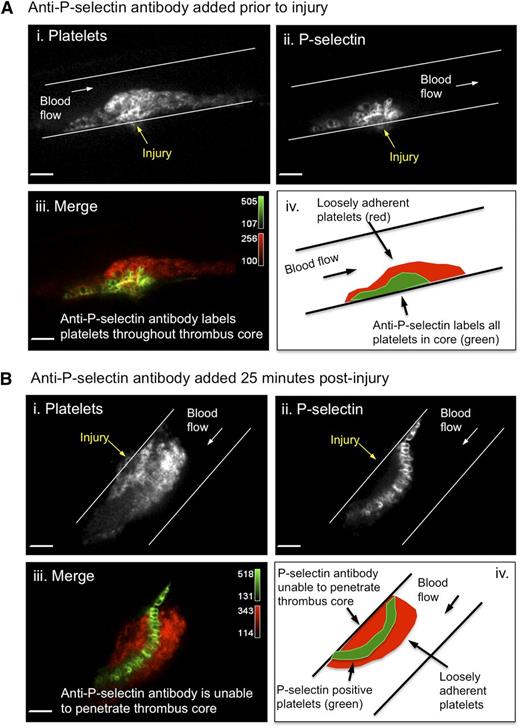 Figure 3. Plasma protein accessibility to the core region is limited. Photomicrographs showing representative hemostatic plugs from 2 different mice. (A) The anti-P-selectin antibody was infused prior to injury and circulating throughout hemostatic plug formation. (B) The anti-P-selectin antibody was infused 25 minutes post-injury. For both A and B, the platelet (i) and P-selectin (ii) channels are shown individually as gray-scale images and the merged image (iii) is shown in color (red, platelets; green, P-selectin). Bars represent 10 µm. A line drawing of the merged images is included for clarity (iv). Note that the P-selectin antibody is unable to penetrate the core region when infused 25 minutes post-injury.