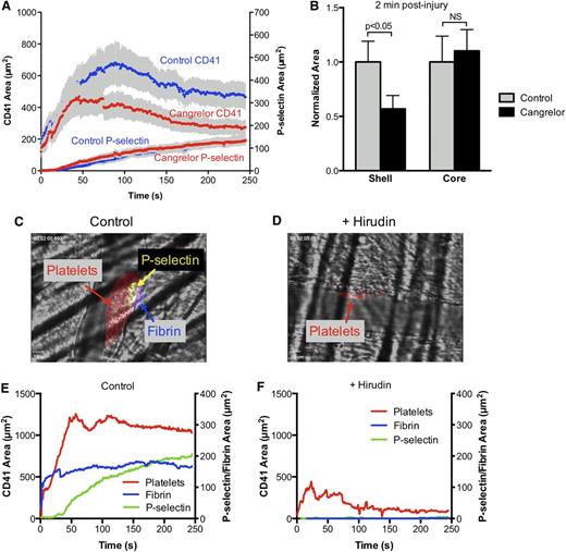 Figure 6. Contribution of ADP and thrombin to the formation of the hemostatic plug core and shell. (A) Graph depicts total platelet accumulation and P-selectin expression over time following laser injury in wild-type mice before (blue lines) and after (red lines) treatment with the P2Y12 antagonist cangrelor. Values are mean area ± SEM for n = 15 injuries before and 24 injuries after cangrelor infusion in 4 wild-type mice. Representative time-lapse videos are included in supplemental Video 5. (B) A comparison of shell and core area 2 minutes post-injury. Data are normalized to mean area of the wild-type for each region and are expressed as mean ± SEM. Statistical analysis was performed by 2-way ANOVA with Bonferroni post-hoc test. (C–F) Impact of thrombin inhibition on the core and shell. Representative photomicrographs show hemostatic plugs 2 minutes post-injury before (C) and after (D) intravenous infusion of hirudin (30 µg/kg prior to injury). Platelets are labeled red, P-selectin is labeled green, and fibrin is labeled blue. Overlay of platelets and P-selectin is yellow and overlay of all 3 fluorophores is white. (E) and (F) Kinetics of hemostatic plug formation for the 2 injuries shown in (C) and (D), respectively. The red line is total platelet accumulation (CD41 area), the green line is P-selectin expression, and the blue line is fibrin accumulation. Time-lapse videos of the hemostatic plugs shown are included in supplemental Video 6. Data are representative of at least 6 injuries in 2 mice.