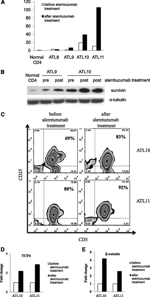 Figure 2. Increased survivin expression in the PBMCs of ATL patients after alemtuzumab treatment. (A) The expression of survivin mRNA levels was measured by real-time reverse transcription–polymerase chain reaction in the ATL PBMCs before and after alemtuzumab treatment (patients ATL8 and ATL11, 1 week after treatment; patients ATL9 and ATL10, 5-6 months after treatment). The fold change was calculated based on the survivin mRNA levels in the normal CD4 cells. (B) Western blot analysis of survivin protein expression levels in patients ATL9 and ATL10 before and after alemtuzumab treatment. (C) Flow cytometry analysis of leukemic cell population (CD3+CD25+) in ATL patients before and after alemtuzumab treatment. (D) Expression of transcription factor TCF4 mRNA in ATL10 and ATL11. Fold change was calculated based on TCF4 mRNA expression before treatment. (E) Expression of β-catenin mRNA in ATL10 and ATL11. Fold change was calculated based on β-catenin mRNA expression before treatment.