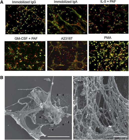 Figure 2. EETosis releases weblike chromatin structures from lytic cells. (A) Eosinophils were stimulated with the indicated stimuli in 0.1% BSA medium for 120 minutes or in A23187 for 60 minutes and fixed. EETosis was detected using extracellular histone staining without permeabilization, as described in “Materials and methods” and supplemental Figure 3. Green indicates histones, and red indicates DNA. Images were obtained using a BX62 microscope (20×, equipped with a Qimaging Rolera EM-C2 cooled digital camera (Surrey, BC, Canada) in conjunction with SlideBook 5.0 image analysis software (Intelligent Imaging Innovations, Denver, CO), or equipped with a Qimaging Retiga EXi cooled digital camera in conjunction with iVision image analysis software). Experiments were repeated with eosinophils from 3 independent donors with similar results. (B) Eosinophils were stimulated with 2 μM A23187 for 60 minutes and processed for SEM. Large DNA nets were released from lytic cells and often were associated with originating cells (outlined by arrows, left). Weblike DNA nets consisted of 25- to 35-nm diameter fibers aggregated into larger fibers (right). Scale bars represent 20 μm (A), 10 μm (B, left panel), and 500 nm (B, right panel).
