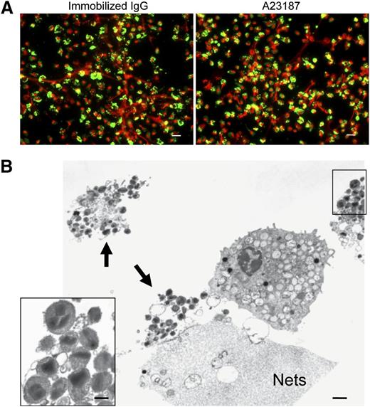 Figure 4. Intact granules and limited granule protein localization at extracellular DNA nets released through EETosis-mediated cell lysis. (A) Eosinophil EETosis was induced using 1 mg/mL immobilized IgG (120 minutes) or 2 μM A23187 (60 minutes) and fixed and permeabilized, then stained for MBP (green) and DNA (PI, red). Most released DNA nets did not contain free granule MBP protein and instead showed punctate or cell-associated staining. Images were obtained with a BX62 Olympus upright microscope, 20× UPlanApo objective with a numerical aperture of 0.70, coupled to a Hamamatsu Orca-AG fire-wire cooled digital camera (Hamamatsu Photonics, Hamamatsu, Japan; images were acquired using iVision software). Data are representative of >3 experiments from independent donors with similar results. (B) Cells were processed for TEM directly on slide surfaces. A23187-induced (2 μM, 60 minutes) EETosis eosinophils exhibit disrupted plasma membranes with clusters of released secretory granules (arrows) and DNA nets (Nets). Extracellular free granules (B, insert) show their typical morphologies with full crystalloid cores and matrices and intact granule-delimiting membranes. Some granules were entrapped in DNA nets. Scale bars represent 20 μm (A), 1 μm (B), and 700 nm (B, insert).