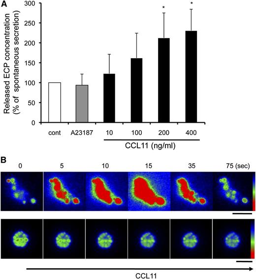 Figure 6. Released granules were secretion competent in response to CCL11. (A) Culture medium of A23187-stimulated cells (2 μM, 90 minutes) was collected, and granule-rich subcellular structures were isolated. The cell-free structures were stimulated with 2 μM A23187 or the indicated concentrations of CCL11 for 60 minutes. Secreted ECP levels, assessed by enzyme-linked immunosorbent assay, were normalized with spontaneous ECP release (100%), and data are expressed as means ± SD, from 3 different donors. *P < .05 vs nonstimulated controls. The spontaneous secretion levels were 10.0 ± 4.4% of the total ECP in the structures. (B) AO-loaded eosinophils were stimulated with 2 μM A23187 to induce EETosis, followed by the isolation of subcellular granule structures. Among the 80 single granules or groups of granules, following CCL11 stimulation, significant responses with intense transient fluorescent flashes indicative of the release of monomeric AO were observed from 14 nonenveloped granules (17.5%). The secretory response was not observed by likely PM-bound clusters of granules (lower panels). Images were obtained with a Hamamatsu Orca-AG fire-wire cooled digital camera coupled to a BX62 Olympus microscope using a 60× PlanApo objective with a numerical aperture of 1.42. Fluorescence intensity was analyzed by iVision software and pseudocolored with red to represent the greatest intensity as indicated by the scale color. Experiments were repeated with eosinophils from 8 independent donors. The scale bar represents 3 μm (B).