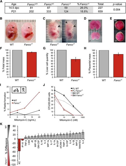 Figure 1. Prenatal manifestation of several FA-associated defects. (A) Fancc+/− crosses yielded an approximately Mendelian frequency of Fancc−/− fetal mice, whereas frequencies of Fancc−/− weanlings were sub-Mendelian. χ2 test comparing fetuses to weanlings yielded a P value of .004. (B) Representative photo of WT and Fancc−/− day 14.5 fetal mice. Units are in millimeters. (C) Malformations observed in some Fancc−/− fetuses: microphthalmia (left); anophthalmia and anencephaly (right). (D) Representative photos of 14.5 days post coitum WT and Fancc−/− fetal livers, and (E) placentas. (F) Fetal mass normalized to WT mean within each litter (nlitters = 5, nWT = 19, nFancc−/− = 14). (G) Cell counts from single cell suspensions of fetal livers normalized to WT mean (nlitters = 6, nWT = 16, nFancc−/− = 13). (H) Placenta weights (nWT = 25, nFancc−/− = 14), P = .009. (I) Chromosome radial formation (%) in WT and Fancc−/− fetal liver cells cultured in mitomycin-c (MM-C; n = 50/condition). Inset image of representative radial (left) and break (right). (J) FL and adult BM hematopoietic progenitor colony formation in methylcellulose (CFU-C) (nFL = 3/genotype, nBM = 1/genotype). Unfractionated cells were plated in the presence or absence of MM-C at 2 × 104 per 35 mm dish and colonies of >50 cells were counted on day 12. (K) Mean percent difference in the secretion of select cytokines from Fancc−/− vs WT fetal liver-conditioned media assayed by cytokine arrays in 3 independent experiments; the cytokines shown are those that yielded consistent results across all 3, whereas those that did not show differential expression are not shown. Error bars represent standard error of the mean. BM, bone marrow; FL, fetal liver; MM-C, mitomycin-c; WT, wild type.