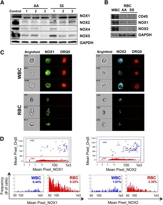 Figure 3. AA and SS RBC contain several NOX isoforms. (A) NOX isoforms are detectable in AA and SS RBC. Western blotting of total RBC lysates reveals the presence of the NOX isoforms NOX1, NOX2 (gp91), NOX4, and NOX5 in both AA and SS RBC. NOX3 could not be detected. Control samples for the different NOX isoforms were human WBC lysate (NOX1 and NOX2), human kidney lysate (NOX4), and human testis lysate (NOX5). (B) NOX1 and NOX2, but not CD45, are detected in AA and SS RBC, indicating that the presence of NOX isoforms in the RBC lysate is not due to WBC contamination. (C) NOX1 and NOX2 are detected by immunofluorescence in intact WBC, as expected, as well as in intact RBC of whole SS blood samples, by multiparameter high-speed cell imaging in flow. (D) Up to 80% of sickle RBC have positive stain for NOX1, with 6% of the erythrocytes having a mean pixel value (expressing the MFI) of NOX1 >50 (arbitrary units), at the level of positivity for NOX1 in WBC within the same sample. NOX2 positivity appear less intense for the sickle erythrocytes in comparison with WBC, with only 2% of the RBC staining as strongly positive as the WBC.