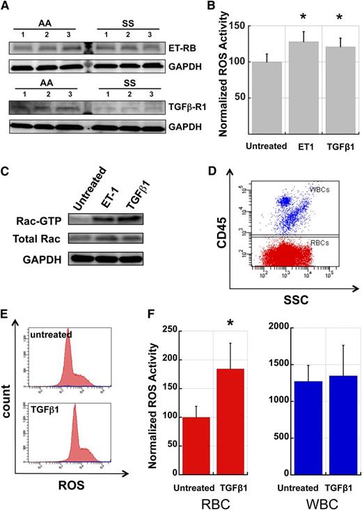 Figure 6. TGFβ1 and Endothelin-1 activate Rac-GTP and stimulate ROS production in AA RBC. (A) AA and SS RBC carry surface receptors to TGFβ1 and ET-1. RBC membrane preparations (pink ghosts) were probed with antibodies against ET-1 Receptor B or TGFβ1 Receptor type 1 as indicated. GAPDH at the same specimen is shown as loading control. (B) Fraction 1 RBC from healthy (AA) donors were incubated for 4 hours in endogenous plasma with or without the addition of exogenous ET-1 (2.5 µM) or TGFβ1 (0.5 µg/ml) and then stained for ROS with CM-H2-DCFDA. n = 15 and P < .05. (C) Fraction 1 AA RBC were incubated with ET-1 or TGFβ-1 as in (B) and then lysed and processed in pull-down assays to determine active Rac (Rac-GTP). Control aliquots of total lysate were immunoblotted for total Rac and GAPDH proteins as quantitative controls for pull-down and loading. The experiment was repeated three times with similar results. (D) Representative flow cytogram demonstrating the CD45 positive WBC mixed with fraction 1 AA RBC (CD45-negative), in order to evaluate relative erythrocyte and leukocyte ROS production. (E) Representative histograms of AA RBC (red) and WBC (blue population along the x-axis) samples without and with TGFβ1 stimulation. (F) Comparative ROS signals and induction of ROS production in AA RBC and WBC by TGFβ-1 stimulation. All ROS signals are normalized to the unstimulated RBC signal. TGFβ1 caused an increase of 84% in RBC ROS production (P < .05) while it only caused a 6% increase in WBC ROS production (n = 5). SSC, side light scatter.