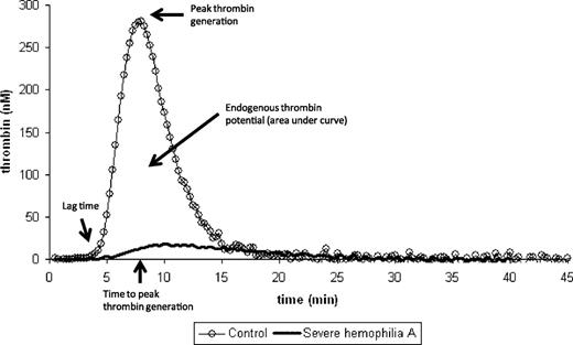 Figure 1. Normal thrombin generation curve. The major parameters (lag time, time to peak thrombin generation, peak thrombin generation, and endogenous thrombin potential) of the thrombin generation curve are shown. For reference, a patient with severe hemophilia whereby all 3 parameters are severely affected is included.