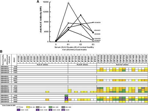 Figure 2. HLA-E reactivity of IgG purified from the sera of normal nonalloimmunized males negative for anti–HLA-E Abs. These sera were obtained from normal volunteers from Saudi Arabia. The sera are identified with AB numbers. The purified IgG showed HLA-E reactivity (A) and reactivity for a variety of HLA-Ia alleles (B). MFI color code appears below data (B). This same color code can be used to assess MFI values in Figures 4 and 7.