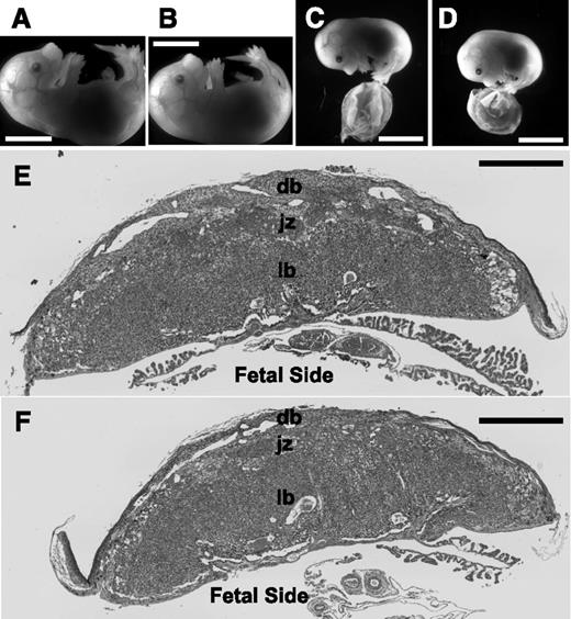 Figure 1. ThbdPro/Pro embryos survive pregnancies of FVQ/QThbdPro/+ females if the mother is treated with LMWH or is deficient in Par3. ThbdPro/Pro (B,D) and littermate ThbdPro/+ (A) and Thbd+/+ (C) embryos from representative pregnancies treated with LMWH (A-B) or with maternal Par3 deficiency (C-D) are shown. These correspond to 16.5 dpc for LMWH treatment and 15.5 dpc for maternal Par3 deficiency. ThbdPro/Pro embryos are growth restricted in pregnancies of Par3−/− FVQ/QThbdPro/+ females (measurements shown in Figure 3A-B). Their placentae tend to be smaller (measurements in Figure 3C) but do not present evidence of overt thrombosis. Hematoxylin-eosin stained histological sections of Thbd+/+ (E) and ThbdPro/Pro placentae (F) corresponding to (C) and (D), respectively, are shown. The plane of sectioning is through the center of the placenta and perpendicular to its flat surface. Regions of the placenta are marked. Scale bars represent 5 mm in (A-D) and 1 mm in (E-F). db, decidua basalis; jz, junctional zone corresponding to basal plate in human placenta; lb, labyrinth or fetal placenta containing trophoblast-covered fetal vessels bathed in maternal blood.