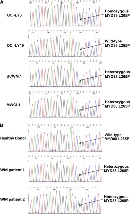 Figure 2. MYD88 L265P in DLBCL and WM cell lines and primary WM patient cells using conventional AS-PCR assay. Detection of MYD88 L265P in OCI-LY3 and OCI-LY19 DLBCL, BCWM.1, and MWCL-1 WM cell lines (A) and primary WM patient tumor cells isolated from BM aspirates (B) by conventional AS-PCR assay. The depicted zygosity of MYD88 L265P in primary WM patient cells shown was confirmed by WGS. The position of MYD88 L265P locus is indicated by arrows. Complementary strand sequences are shown.