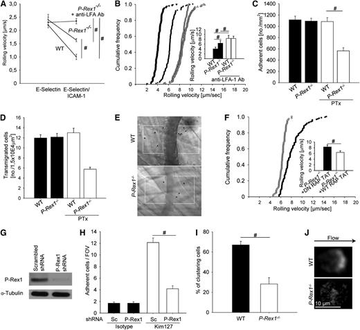 Figure 1. P-Rex 1 is required for E-selectin-mediated slow leukocyte rolling and Gαi-independent adhesion. (A) Carotid arteries of P-Rex1−/− mice (n = 3), P-Rex1−/− mice after injection of a blocking anti-LFA-1 antibody (n = 3) and WT mice (n = 3) were cannulated and connected to autoperfused flow chambers. Average rolling velocity of neutrophils on E-selectin (left) and E-selectin and ICAM-1 (right) is presented as means ± SEM. The wall shear stress in all flow chamber experiments was 5 to 6 dyn/cm2. (B) Cumulative histogram of rolling velocities of WT (n = 4) leukocytes before (▼) and after injection of a blocking anti-LFA-1 antibody (Δ) and corresponding values for P-Rex1−/− (n = 4) leukocytes (● and ○) in inflamed cremaster muscle venules treated with Pertussis Toxin (PTx) and a monoclonal blocking anti-P-selectin antibody. Inset data are means ± SEM. (C) Numbers of adherent cells per square millimeter in TNF-α inflamed cremaster venules after PTx pretreatment in WT (n = 4) and P-Rex1−/− (n = 4) mice and without PTx (n = 3 each). (D) Number of transmigrated cells per 1.5 × 104 μm2 in inflamed cremaster venules of WT (n = 4) and P-Rex1−/− (n = 4) mice with and without PTx (n = 3 each) as determined by near infrared reflected light oblique transillumination microscopy. (E) Representative images of inflamed cremasteric venules of WT (upper panel) and P-Rex1−/− (lower panel) mice as visualized using reflected light oblique transillumination microscopy. (F) Cumulative histogram depicting rolling velocities of leukocytes treated with either a cell-penetrating TAT peptide fused to a WT form (n = 3) of Rap1a (○) or to an dominant negative Rap1a (n = 3) with a S17N mutation (●) in inflamed cremaster venules of LysM GFP+ mice after pretreatment with PTx and injection of a blocking P-selectin antibody. Inset data are means ± SEM. (G) P-Rex1-knockdown HL-60 cells were generated using short hairpin RNA and knockdown efficiency of P-Rex1 was confirmed by western blot analysis. (H) HL-60 cells were analyzed using a flow chamber adhesion assay with E-selectin and either an antibody specific for the intermediate confirmation of LFA-1 (KIM127) or an isotype control. Adherent cells per field of view were counted and means ± SEM are displayed. (I) Clustering of LFA-1 during slow rolling of leukocytes in inflamed venules of the cremaster muscle in WT (n = 3) and P-Rex1−/− mice (n = 3). Bars are percentage of clustering cells ± SEM. (J) Representative images of WT (upper panel) and P-Rex1−/− (lower panel) rolling leukocytes stained with anti-LFA-1 antibody. #P < .05.