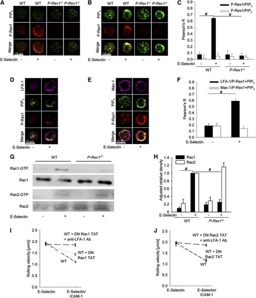 Figure 2. P-Rex1 co-localizes with PIP 3 at the plasma membrane leading to Rac1 activation and LFA-1 clustering. (A-B) Co-localization of P-Rex1 (red), PIP2 (green; A), and PIP3 (green; B) in WT (left) and P-Rex1−/− (right) neutrophils with and without E-selectin stimulation. Displayed are representative cells of 3 independent experiments. (C) Quantitative analysis of co-localization of PIP2 vs P-Rex1 and PIP3 vs P-Rex1, respectively. (D) Co-localization of P-Rex1 (red), PIP3 (green), and LFA-1 (purple) after E-selectin stimulation in WT and P-Rex1−/− neutrophils. Shown are representative images of 3 independent experiments. (E) Co-localization of P-Rex1 (red), PIP3 (green), and Mac-1 (purple) after E-selectin stimulation in WT and P-Rex1−/− neutrophils. Shown are representative images of 3 independent experiments. Scale bars indicate 10 μm. (F) Quantitative analysis of the co-localization of P-Rex1 and PIP3 with Mac-1 or LFA-1. (G) Representative western blots of Rac1 and Rac2 activity without stimulation and after stimulation with E-selectin in WT and P-Rex1−/− neutrophils (n = 3). (H) Densitometric analysis of Rac1 and Rac2 activity assays (n = 3) normalized to stimulated WT cells. Bars are adjusted relative density ± SEM. (I) Flow chamber of neutrophils preincubated with WT and DN Rac1 peptides on ICAM-1 and E-selectin/ICAM-1. (J) Corresponding flow chamber of neutrophils preincubated with WT and DN Rac2 peptides. #P < .05.