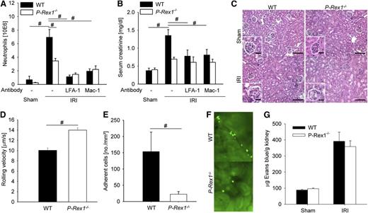 Figure 5. Mice deficient for P-Rex1 are protected from renal ischemia-reperfusion injury. (A) Mean numbers of neutrophils per kidney 24 hours after ischemia-reperfusion injury or sham operation as determined by flow cytometry analysis ± SEM in WT mice (n = 5), P-Rex1−/− mice (n = 4), and WT mice pretreated with a blocking antibody against LFA-1 (n = 3) or Mac-1 (n = 3). (B) Serum creatinine levels in the blood of WT mice (n = 5), P-Rex1−/− mice (n = 4), and WT mice pretreated with a blocking antibody against LFA-1 (n = 3) or Mac-1 (n = 3) subjected to ischemia-reperfusion injury and sham operation (n = 3 each) 24 hours after the intervention ± SEM. (C) Representative hematoxylin and eosin stainings of kidney outer medulla from WT mice and P-Rex1−/− mice were assessed 24 hours after sham operation or renal IRI. Bar represents 50 μm. (D) Rolling velocities of labeled WT (n = 3) and P-Rex1−/− (n = 3) neutrophils 4 hours after ischemia reperfusion in cortical venules of the kidney. Bars are means ± SEM. (E) Mean numbers of labeled adherent cells per square millimeter in cortical kidney venules 4 hours after ischemia-reperfusion injury in WT mice injected with either labeled WT (n = 3) or P-Rex1−/− (n = 3) bone marrow ± SEM. (F) Representative image of renal cortical venules 4 hours after ischemia-reperfusion injury in mice injected with labeled WT (above) or P-Rex1−/− (below) bone marrow. (G) Permeability of kidney vessels as measured by quantification of extravasated Evans blue in WT mice and P-Rex1−/− mice after sham operation or ischemia-reperfusion injury ± SEM. #P < .05.