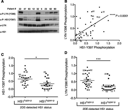 Figure 2. HS1-Y397 phosphorylation correlates with LYN-Y396 activation in a subset of CLL patients. (A) Phosphorylation of the activatory residues on LYN and HS1 (2 upper panels) were evaluated by WB of representative primary CLL samples (patient numbers are as in supplemental Tables 1 and 2) with anti–phosphoLYN-tyrosine396 (α-P-LYN-Y396) and α-P-HS1-(Y397) antibodies, showing the concordant presence of the phosphorylation on both proteins. Total LYN and HS1 protein levels are shown (2 lower panels), as a control. (B) In the linear regression graph, OD values of LYN-Y396 phosphorylation (OD ratio between LYN-Y396 phosphorylation and the total LYN protein levels, y-axis) analyzed by densitometry of WB results from 40 primary CLL samples are represented and show significant direct correlation with the OD values of HS1-Y397 phosphorylation (OD ratio between HS1-Y397 phosphorylation and the total HS1 protein levels, x-axis). The numbers in the plot refer to the representative patients displayed in (A). (C) In the dot plot, means ± SEM of the OD values of HS1-Y397 phosphorylation, calculated as in (A), from 40 primary samples divided into 2 groups based on 2DE-detected HS1 status (HS1hypo-p, HS1hyper-p), show high HS1-Y397 activation in HS1hypo-p cells but low HS1 activation in HS1hyper-p cells (n = 22 HS1hypo-p vs n = 18 HS1hyper-p). The numbers in the dot plot refer to the representative samples displayed in (A). (D) In the dot plot, means ± SEM of the OD values of LYN-Y396 phosphorylation, calculated as in (A), from 47 primary samples divided into 2 groups based on 2DE-detected HS1 status (HS1hypo-p, HS1hyper-p), show high LYN-Y396 activation in HS1hypo-p cells but low LYN activation in HS1hyper-p cells (n = 27 HS1hypo-p vs n = 20 HS1hyper-p). The numbers in the dot plot refer to the representative samples displayed in (A). *P ≤ .05; ***P ≤ .001, Mann-Whitney U test; ****P < .0001, Spearman rank correlation.
