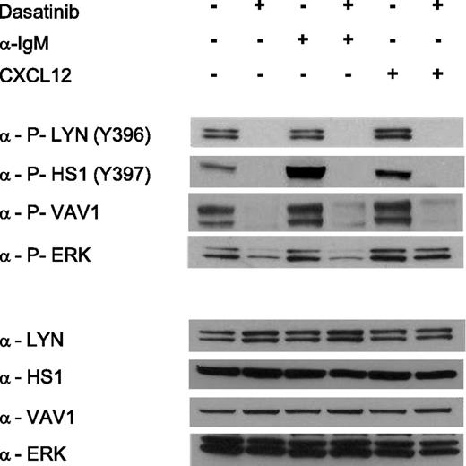 Figure 4. LYN inhibition abrogates HS1-Y397 phosphorylation and reduces VAV1 and ERK activation. In the first 4 upper panels, the phosphorylation status of LYN-Y396, HS1-Y397, VAV1, and ERK was evaluated by WB (representative of 6 different patients) before and after treatment with 100 nM dasatinib for 1 hour, anti (α)-IgM for 5 minutes, CXCL12 for 5 minutes, or with a combination of dasatinib/α-IgM or dasatinib/CXCL12. Immunoblotting shows that blocking LYN kinase activation by dasatinib interferes selectively with HS1-Y397, VAV1, and ERK activation, also in the presence of BCR and CXCR4 stimulation by α-IgM and CXCL12, respectively, though at a more limited degree in the case of ERK. In the 4 lower panels, total levels of each protein tested are displayed as control. +, presence of the treatment; −, absence of the treatment.