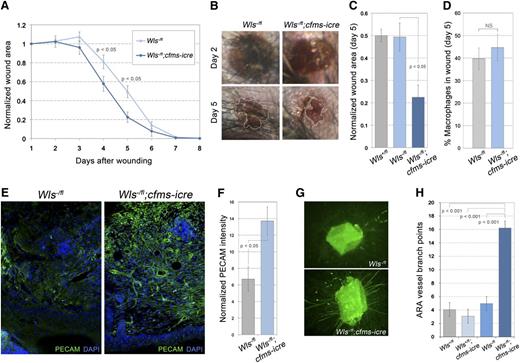 Figure 1. Macrophage Wnts suppress wound repair and angiogenesis. (A) Time-course of wound area in control and homozygous null Wls animals. (B) Images of wounds 2 and 5 days after initial injury (×20). (C) Quantification of wound area at day 5. (D) Percentage of F4/80-positive cells (macrophages) in control and mutant wounds. (E) Immunolabeling of wound sections for vasculature (PECAM) in control and null animals (×100). (F) Quantification of PECAM staining intensity per unit area in control and null wounds that was normalized to adjacent avascular epidermis. (G) Images of ARAs after 10 days of culture stained with isolectin-B4 (×50). (H) Quantification of ARA vessels in Wls control and mutant aortas. Statistical analysis performed was Student t test (A, D, F) and one-way analysis of variance with Tukey’s post-hoc test (C, H) using SPSS (IBM, Armonk, NY) software.