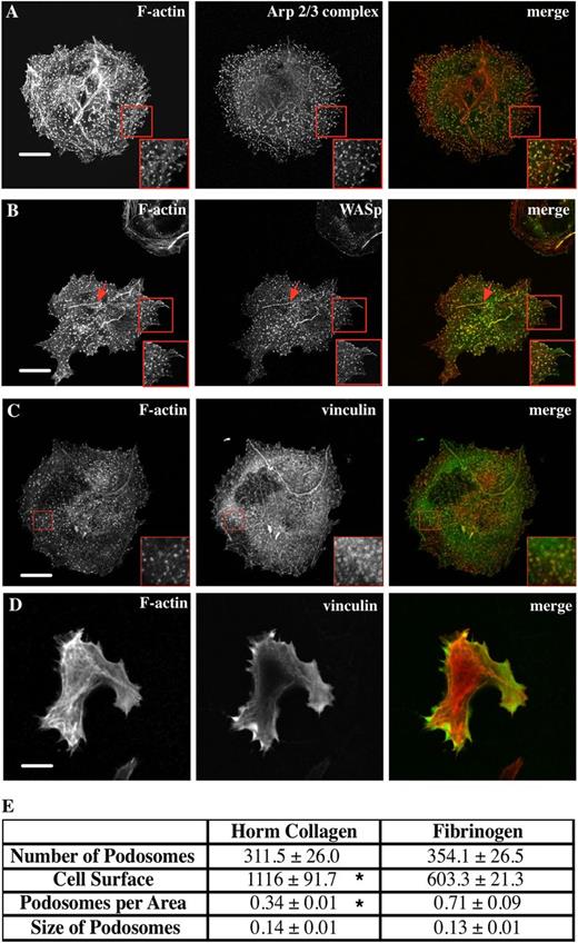 Figure 1. Mks form abundant podosomes on Horm collagen and fibrinogen matrix. Mks were spread on 100 μg/mL Horm collagen-coated surfaces for 3 hours and then fixed and stained for F-actin and (A) the Arp2/3 complex, (B) WASp, and (C) vinculin. (D) Mks spread on collagen from WASp−/− mice were stained for F-actin and vinculin. The right column of pictures shows the merge of F-actin (red, phalloidin) and WASp, Arp2/3 complex, or vinculin (green). Red squares indicate magnified area of the cell. Red arrows in panel B indicate podosomes along what appears to be a collagen fiber. (E) Table shows the average plus or minus the standard error of the mean (SEM) for the spread Mk surface area in µm2, the mean number of podosomes formed, podosomes formed per μm2, and the size of podosomes for Mks spread for 3 hours on 100 μg/mL Horm collagen or 100 μg/mL fibrinogen-coated surfaces fixed and stained for F-actin and WASp. The podosome size was determined by measuring at least 100 podosomes of 5 different cells per experiment. Data are representative of 3 experiments. Asterisk indicates significant difference between collagen and fibrinogen data with a P value < .05. Pictures were taken with a confocal microscope using a 60× objective. Scale bars represent 10 μm.