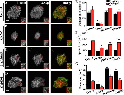Figure 3. Mk podosome formation requires the activity of the Arp2/3 complex. Cells were spread for 3 hours on 100 μg/ml Horm collagen-coated surfaces fixed and stained for F-actin (green) and WASp (red). The right panel of pictures shows the merge of both channels. The cells were treated with different inhibitors: (A) 0.1% DMSO was used as control for (B) 20 μM CK666, (C) 10 μM blebbistatin, (D) 5 μM GM6001. Scale bars represent 10 μm. Quantification of the effect of the inhibitors on (E) the number of podosomes, (F) cell surface area, and (G) podosomes per μm2 were determined on Horm collagen (red columns) or fibrinogen (black columns). Statistical analysis was done using a 1-way analysis of variance. Asterisk indicates significant difference from the control value with a P value < .05. Error bars indicate ±SEM. Data are representative of 3 experiments.