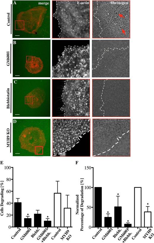 Figure 5. Fibrinogen degradation depends on MMPs and myosin IIA activity. Mks were spread on 100 μg/mL 488-labeled fibrinogen-coated surfaces (green) for 3 hours and stained for F-actin (red) in the presence of (A) 0.1% DMSO as control for (B) 5 μM GM6001 and (C) 10 μM blebbistatin. (D) MYH9−/− Mks were spread on 488-labeled fibrinogen-coated surfaces. Pictures show from left to right the merge of F-actin and fibrinogen, with red squares indicating magnified areas of F-actin and fibrinogen and dotted lines marking the outline of the cell. (E) The percentage of Mks that were degrading fibrinogen was analyzed and (F) the percentages of total degradation were measured and normalized. Black columns represent inhibitor-treated samples, and white columns represent control and MYH9−/− Mks. Images were taken with a confocal microscope using a 60× objective. A total of 20 cells were analyzed per experiment for n = 6 experiments. Scale bars represent 10 μm. Statistical analysis was done with a Student t test. Asterisk represents significant difference with a P value < .05. Error bars indicate ±SEM. Blebb., blebbistatin; KO, knockout.