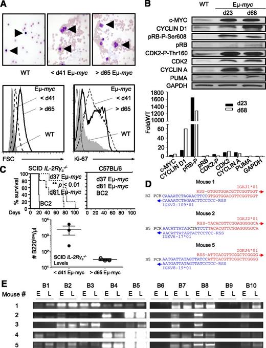 Figure 2. Early B220low cells are clonal precursors of postregression tumor cells. (A) Smear preparation of blood of pre- and postregression Eμ-myc mice. Giemsa-stained blood smears from WT revealed lymphocytes with small nuclei (upper left) while those from Eμ-myc mice at <41 days of age (upper middle) and >65 days of age (upper right) showed atypical lymphoid cells with enlarged and irregular nuclei. Arrows indicate lymphoid cells. Giemsa-stained blood smears were analyzed by light microscopy at original magnification ×600. B220low cells of WT (filled gray), preregression Eμ-myc mice (dashed line), or postregression Eμ-myc mice (black line) were assessed for size by forward light scatter (lower left panel) and for intracellular KI-67 expression (lower right) by flow cytometry. (B) Expression levels of cell-cycle–related proteins in splenic B220+ cells of Eμ-myc mice at 23 and 68 ± 2 days of age and B220+ cells of WT mice at 23 days of age. Quantification of bands is shown in lower panel. Expression levels were normalized to WT levels. Shown is 1 of 3 representative experiments. (C) Splenic B220low cells isolated from Eμ-myc mice at 37 and 81 ± 2 days of age were analyzed for malignant transformation by transfer of 5 × 106 B220+ cells into SCID IL-2Rγc−/− mice. BC2 cells, a cell line derived from Eμ-myc mice, were transferred as a positive control. Kaplan-Meier survival curve of SCID IL-2Rγc−/− (left panel) or WT mice (right panel) after transfer of B220+ cells (top panel). In a separate experiment, 5 × 106 splenic B220+ cells of individual Eμ-myc mice before 41 and after 65 days of age were transferred into different SCID IL-2Rγc−/− mice. The number of B220low cells in the blood of SCID IL-2Rγc−/− mice 77 days after transfer was determined as outlined in Figure 1C. Mean number of B220low cells in the blood of SCID IL-2Rγc−/− mice is represented by a black line (bottom). (D) V-J junction sequences of the immunoglobulin κ light chain of pre- and postregression tumors. Complimentary DNA samples of preregression and postregression Eμ-myc mice (n = 5) were amplified by PCR using primers hybridizing to related sets of V regions of the κ light-chain genes in combination with a primer specific for the constant region (see “Methods” and supplemental Figure 4). Identical V-J junction sequences of pre- and postregression tumors of 3 out of 5 mice are shown. No successful V-J recombinations were found in the remaining 2 mice. Successful V-J junctions were compared with germline sequence of C57BL/6 mice using IMGT/V-QUEST (http://www.imgt.org). Blue letters show the V region, red letters indicate the J region, and black letters show mutations. (E) Complimentary DNA of blood tumor cells of pre- and postregression Eμ-myc mice was amplified using primers specific for different variable regions of the κ light chain and a common primer specific for the constant region of the light chain according to the manufacturer’s instructions (Progen Biotechnik GmbH, Heidelberg, Germany). d, day; E, tumors before 41 days of age; FSC, forward light scatter; L, tumors after 65 days of age; RSS, recombination signal sequences.