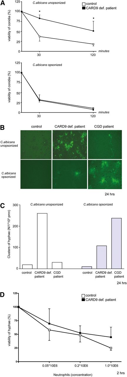 Figure 4. Killing of C albicans by CARD9-deficient neutrophils. (A) Killing efficacy of patient and control neutrophils of unopsonized and opsonized C albicans conidia was assessed by standard colony-forming unit assay. Patient and control neutrophils were incubated with C albicans conidia for 2 hours, and the colonies were counted after overnight incubation of the remaining Candida conidia. Results are means ± SEM of at least 3 different assays; *P < .05. (B) Neutrophils from healthy controls, from the CARD9-deficient patient and from CGD patients (n = 9), were cocultured overnight with C albicans–GFP and assessed microscopically. Massive outgrowth of the hyphenated form of C albicans–GFP was observed, when cocultured overnight with CARD9-deficient cells. Bright-green fluorescence of hyphae indicates viable Candida. Such outgrowth was not detected when C albicans was cocultured with control neutrophils. (C) Clusters of hyphae were quantified after overnight incubation of 1 × 105 neutrophils with different numbers of Candida conidia. Data are representative for at least 3 experiments. Original magnification, ×20; scale bar, 200 μm. (D) The capacity of patient and control neutrophils to kill Candida hyphae was determined by MTT assay. Neutrophils in different concentrations were incubated with monolayer of Candida hyphae for 2 hours. The viability of hyphae was assessed by the MTT assay. Results are means ± SEM of at least 3 different assays.