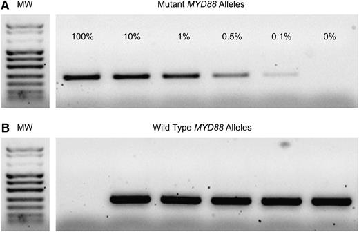 Figure 1. MYD88 AS-PCR sensitivity assay. Serial dilutions of mutated and wild-type alleles (from 100% to 0% mutated alleles) were performed to identify the analytical sensitivity of AS-PCR. (A) Sensitivity of the method was ≥0.1%. (B) Amplification of the wild-type allele. All samples give rise to the wild-type MYD88 band, except for the 100% mutant allele sample.