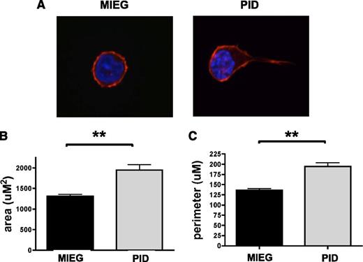 Figure 2. Inhibition of PAK in HSPC leads to excessive cell spreading and protrusions in response to SDF-1 chemokine stimulation. WT LSK was transduced with PID or MIEG3 retrovirus. GFP+ LSK were isolated 48 hours later using fluorescence-activated cell sorter, and were stimulated with SDF-1α and plated on fibronectin-coated coverslips. (A) PID transduced LSK showed aberrant cell morphology compared with MIEG3 controls in response to stimulation with SDF-1α for 5 minutes and staining of F-actin with rhodamine-labeled phalloidin (red) and DAPI-stained nuclei (blue). The changes in cell shape were quantified by (B) total cell area (uM2) and (C) cell perimeter (uM). Data represent mean ± SEM (N ≥ 40 cells analyzed per group). **P < .001.