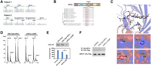 Figure 1. Novel HIF2A mutations disrupt cellular oxygen sensing. (A) Mutation analysis showing heterozygous mutation of HIF2A gene in tumor specimen but not adjacent normal tissue. (B) Peptide sequence alignment of prolyl hydroxylation domain of HIF-2α. (C) Electrostatic changes of single-site mutations in PHD2-HIF-α complex. Interaction between leucine (L) and tyrosine (Y) and PHD2 residues (top) and electrostatic changes resulting from L529P and Y532C substitution (bottom; red, negative; blue, positive; ±5 kT/e) (D) Peptide hydroxylation assay through matrix-assisted laser desorption ionization-time-of-flight showing absent hydroxylation in ΔHIF-2α-L529P mutant. (E) Peptide binding assay of radioactive labeled VHL and HIF-2α-derived peptides, showing reduced VHL binding in HIF-2α mutant. (F) Immunoprecipitation assay showing decreased VHL binding in HIF-2α mutant.