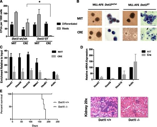 Figure 2. Dot1l deletion impairs the transforming capacity of MLL-AF6–transformed bone marrow cells. (A) Differential colony counts from Dot1l-excised, MLL-AF6–transformed cells 7 days after Cre transduction compared with vector (Mi-Tomato)-expressing controls (n = 3 independent experiments). Light gray bars represent dense and compact blast-like colonies, whereas dark gray bars represent small and diffuse colonies showing marked features of differentiation. Colony-forming units (CFU)/1000 cells averaged from 3 independent experiments are plotted with standard error of the mean (SEM) values. *P value = 0.002. (B) Morphological changes in colony and cell types upon Dot1l deletion in bone marrow cells immortalized by MLL-AF6 (colonies, ×10; cell morphology, ×40). (C) Enrichment of H3K79me2 normalized to input DNA on the chromatin locus of Hoxa/Meis1 gene promoters as assessed by quantitative reverse-transcription (qRT)-PCR is shown 6-9 days after Cre transduction compared with Mi-Tomato–transduced cells (n = 2 independent experiments). (D). RT and qRT-PCR 5 days after transduction with Cre-Mi-Tomato or Mi-Tomato. Expression levels normalized to Gapdh and expressed relative to Mi-Tomato–transduced cells (set to 100%) are shown. Error bars represent the SEM (n = 2 independent experiments). (E) Survival curves for mice injected with 2 × 105 wild-type or Dot1l-excised MLL-AF6 primary leukemia cells (left). Hematoxylin and eosin staining showing blast infiltration in the kidney of a representative leukemic mouse injected with Dot1l +/+ MLL-AF6 leukemias is presented (right). Staining from a disease-free mouse injected with Dot1l −/− cells and sacrificed at an identical time point after injection is shown for comparison.