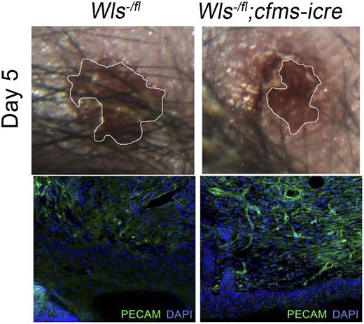 Macrophage Wnts suppress wound repair and angiogenesis. Wound area in control and homozygous null Wls animals at day 5 after initial injury (top panels) and immunostaining for wound vasculature (PECAM) in control and null animals (bottom panels). See the complete Figure 1 in the article by Stefater et al that begins on page 2574.