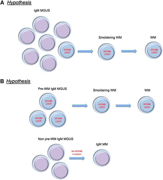 Alternative hypotheses proposed for the MYD88 L265P mutation in IgM-MGUS and WM pathogenesis. (A) MYD88 L265P mutation is a critical and universal progression event from IgM-MGUS to WM. (B) There are various biologic subtypes of IgM MGUS, and the MYD88 L265P mutation is found in the subtype that originates WM.