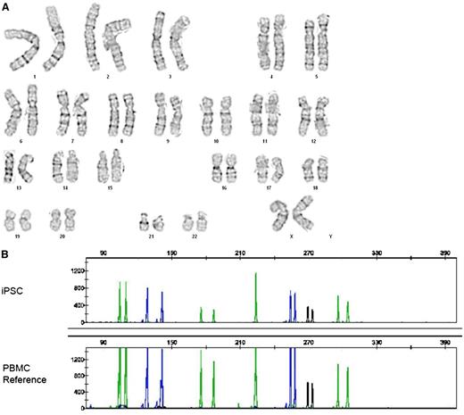 Figure 3. G-band karyotype analysis and DNA fingerprint analysis of iPSCs. (A) Cytogenetic analysis of a representative nonmobilized CD34+-cell–derived iPSC line after Cre-mediated excision of STEMCCA-loxP, demonstrating a normal karyotype. (B) The identity and origin of that iPSC line is confirmed by DNA microsatellite analysis at 7 loci in comparison with PBMCs derived from that patient. DNA samples were PCR amplified using the Applied Biosystems AmpF? STR COfiler kit and the PCR products were analyzed with an ABI 3130XL Genetic Analyzer using GeneMapper software.