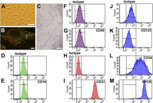Figure 1. Phenotypic and functional analysis of BOECs. (A) Cobblestone-like morphology of BOECs under bright field microscopy. (Scale bar, 100 μm.) (B) BOECs store VWF (shown in red) and P-selectin (shown in green) in WPB. Yellow indicates the costorage of VWF and P-selectin in WPB (elongated organelles). Image was taken by Leica SL confocal laser scanning microscopy with a 63×/1.40 NA oil objective. (Scale bar, 10 μm.) (C) BOECs formed capillary-like structures in Matrigel. (Scale bar, 200 μm). (D-M) FACS analysis of BOECs derived from a single healthy donor. The representative data demonstrate that BOECs were negative for leukocyte cell makers CD14 (D, isotype; E, CD14) and CD45 (F, isotype; G, CD45) but positive for endothelial cell markers CD31 (endothelial cell marker CD31; H, isotype; I, CD31) and EPCR (J, isotype; M, EPCR). In addition, BOECs completely lost expression of the stem cell maker CD133 (J, isotype; K, CD133), although the majority of cells still express the progenitor cell marker CD34 (J, isotype; L, CD34). Shown are representative data from at least 4 independent experiments using BOECs derived from a single healthy donor. Cells derived from other healthy donors and the patients showed similar results.