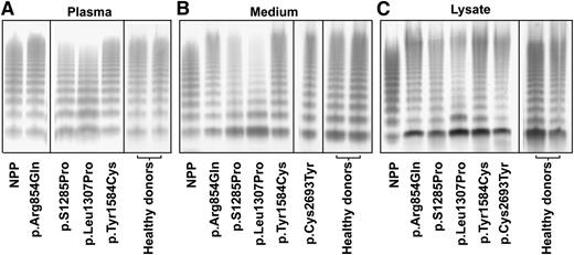 Figure 3. Multimer analysis of VWF. Multimers are shown for VWF in the plasma from indicated patients (A), in the culture medium (B), or in the cell lysates (C) of BOECs. The lanes separated by the black lines are representative results from the same gels or from different experiments. Normal pooled plasma (lane NPP) was used as reference. The plasma of the patient heterozygous for p.Cys2693Tyr was unfortunately no longer available, but the multimer pattern for this patient has been reported before as normal.29 VWF multimer pattern of all healthy donors was normal; only 2 representative patterns are shown. The multimer patterns of VWF were analyzed by sodium dodecyl sulfate–agarose gel electrophoresis and Western blot under nonreducing conditions.