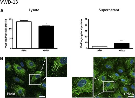 Figure 5. BOEC characterization: type 2A VWD. (A-B) Data from patient VWD-13. (A) VWF was measured by ELISA in the total cell lysate (left) and cell culture supernatant (right) from BOECs isolated from a type 2A VWD patient in the absence and presence of PMA stimulation (mean ± SEM from 3 replicates). (B) VWF expression from control or PMA-stimulated BOECs was visualized by confocal IF microscopy (scale bars represent 20 µm). Boxes show 2× magnified image. *P < .05; ***P < .001.