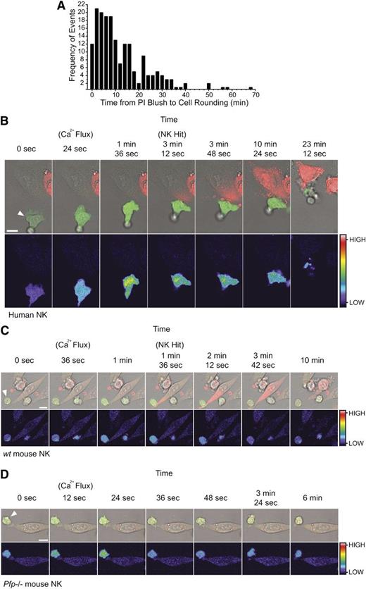 Figure 4. The synchronization of effector cell activation and target cell rounding relative to target cell PI uptake. Target cells rapidly round following uptake of PI. (A) Frequency distribution of the times (minutes) between the PI blush to the first sign of cell rounding. Columns represent 2-minute time intervals (n = 186 apoptotic target cell deaths from 3 independent human donors). Effector cell activation precedes target cell PI uptake. (B) Time-lapse microscopy of 1 µM Fluo-4-AM–labeled human NK cells with HeLa target cells. Images depict an increase in NK Fluo-4 fluorescence on attachment to the HeLa target (24 seconds), prior to PI uptake by the target (3 minutes, 12 seconds), and subsequent detachment of the effector cell (23 minutes, 12 seconds). Images are representative of 5 to 10 cells from 6 independent experiments (using 6 different human donors). See also supplemental Movie S3. (C) Time-lapse microscopy of 1 µM Fluo-4-AM–labeled wt mouse NK cell with a MC57 target cell showing an increase in NK Fluo-4 fluorescence on attachment to the MC57 target (36 seconds to 1 minute) and prior to PI uptake by the target (1 minute, 36 seconds). Images are representative of 5 to 10 cells from 3 independent experiments. See also supplemental Movie S4. (D) Time-lapse microscopy of 1 µM Fluo-4-AM–labeled pfp−/− mouse NK cell with a MC57 target cell showing an increase in NK Fluo-4 fluorescence on attachment to the MC57 target (12-24 seconds) but no subsequent PI uptake. Images are representative of 5 to 10 cells from 3 independent experiments. See also supplemental Movie S5. All images (B-D) were acquired every 12 seconds and show Fluo-4(green)/PI(red)/Brightfield overlay (top) and Fluo-4 pseudocolor (bottom; color bar indicates the pixel intensity). White arrows indicate the NK effector cell. Scale bars, 10 µm.