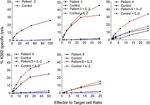 Figure 1. GATA2-deficient patients have defective NK cell cytotoxicity. NK cell functional activity was measured against susceptible K562 target cells in the presence of IL-2 where indicated (dashed line) using PBMCs isolated from whole blood. PBMCs from 5 patients (blue) were evaluated in combination with gender-matched controls (red).