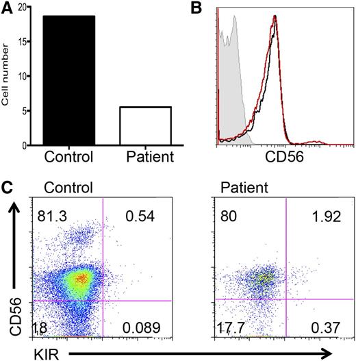 Figure 5. GATA2 is required for NK cell differentiation from CD34+ precursors. Highly purified CD34+ hematopoietic precursors from GATA2-deficient patient 3 or a healthy donor were isolated from peripheral blood by FACS and cultured on EL08.1D2 stromal cells in the presence of IL-3, IL-6, IL-7, stem cell factor, Flt3L, and IL-15. After 30 days, cells were isolated and (A) expansion was calculated based on cell number recovered for control (black) and patient (white). (B) Patient cells (black) and control cells (red) were analyzed for CD56 expression. Control cells were 2.3% CD56bright. Isotype control staining is shown in gray. (C) CD56 on (left) control cells or (right) patient cells was analyzed in combination with pan-KIR antibody (bottom).