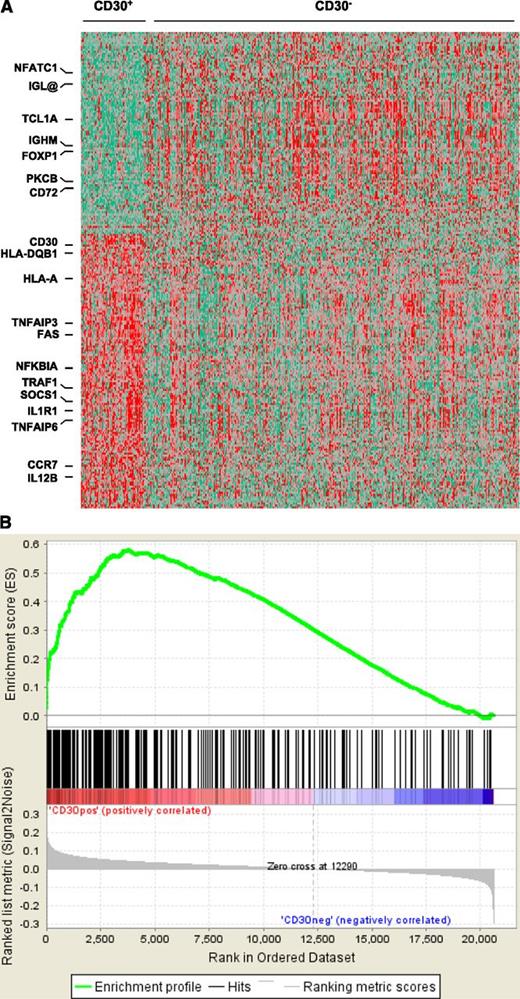 Figure 4. Gene expression profiles and GSEA analysis of CD30+ vs CD30– DLBCL. (A) Comparison of gene expression profiles between CD30+ and CD30– DLBCL. (B) GSEA for differentially expressed genes of cytokine and TNFR pathways was performed on Kyoto Encyclopedia of Genes and Genomes pathway gene sets using all the probe sets that are associated with a known gene. The gene sets with a false discovery rate q value <0.05 after performing 1000 permutations were considered to be significantly enriched.