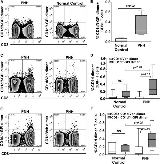 Figure 3. CD1d/GPI dimer staining of T cells. (A) Representative flow cytometry plots showing ex vivo staining of patient and control PBMCs with anti-CD8 and CD1d/t-GPI dimer followed by analysis by multiparameter flow cytometry. Plots shown are gated on DAPI−CD14−CD19−CD3+ cells. (B) Cumulative data showing frequency of CD8+CD1d/t-GPI dimer+ T cells from 4 PNH patients and 4 healthy controls after ex vivo staining of PBMCs as described in panel A (staining with CD1d/Veh dimer was not performed in this set of experiments). (C) Representative flow cytometry plots showing staining of patient CD8+ T cells with (left) CD1d/t-GPI or (right) unloaded dimer after 14 days of coculture with C1R-CD1d cells loaded with t-GPI. Gating strategy as described in panel A. (D) Cumulative data showing frequency of CD8+ CD1d/t-GPI dimer+ vs CD1d/Veh dimer+ T cells from patients (n = 7) and controls (n = 11), after 14 days of coculture of CD8+ T cells with C1R-CD1d cells loaded with t-GPI (1-way analysis of variance with Tukey multiple comparison test; NS, not significant). (E) Staining of CD8+ T cells with CD1d/h-GPI dimer or CD1d/Veh dimer after 14 days of coculture with C1R-CD1d cells loaded with h-GPI. Gating strategy as described in panel A. Staining of T cells from a PNH patient is shown. (F) Cumulative data from 10 PNH patients and 7 normal controls.