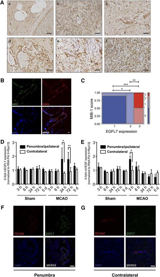 Figure 7. EGFL7 expression in various CNS pathologies. (A) Representative pictures of different human pathology specimens include (a) angioma, a vascular malformation without neoplastic potential associated with no or low levels of EGFL7 expression; (b) hemangioblastoma (World Health Organization grade I), a slowly growing neoplasm characterized by moderate EGFL7 levels; (c) necrotic meningioma exhibiting tissue remodeling and high levels of EGFL7; (d) angiosarcoma, a fast-growing neoplasm associated with strong EGFL7 expression and nonneoplastic lesions; (e) granulation tissue; and (f) infarct resorption characterized by very strong EGFL7 protein levels. Bar represents 50 µm. (B) Costaining of a human hemangiosarcoma with anti-EGFL7 and anti-PECAM (a blood vessel marker) antibodies revealed that most EGFL7 is detected in blood vessels. Bar represents 10 µm. (C) For statistical analysis, the endothelial MIB-1 score was used as ordinal scaled response variable and analyzed together with the ordinal explanatory variable (EGFL7 expression: low expression, n = 10; moderate expression, n = 3; strong expression, n = 4) using a contingency table followed by likelihood-ratio test (low vs moderate EGFL7 expression, *P = .002; moderate vs strong EGFL7 expression, **P = .0084; low vs strong EGFL7 expression, ***P = .0008). Statistical analysis was performed using JMP 8.0 software (SAS, Cary, NC). (D) qRT-PCR revealed a significant upregulation of EGFL7 in the penumbra of stroke 24 and 72 hours after cerebral ischemia induction using a reversible MCAO mouse model (mean ± SEM, n = 6, *P < .01, **P < .005). (E) Likewise, VEGF levels were maximally elevated 3 hours postinduction (mean ± SEM, n = 6, *P < .01). (F) Twenty-four hours postinduction of cerebral ischemia, EGFL7 expression was restricted to blood vessels in the stroke penumbra (G) but was not spotted in blood vessels of the contralateral hemisphere as detected by immunohistochemical staining using EGFL7- and PECAM-specific antibodies. Bar represents 50 µm.